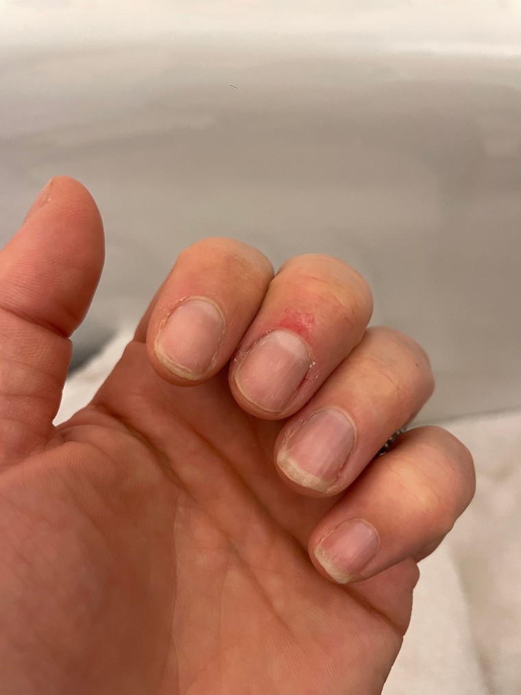 I stopped biting my fingernails. Will the pink part lengthen toward the end  of my fingers? - Quora