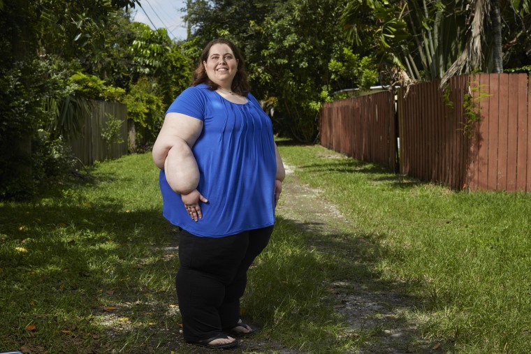 Sarah Bramblette, a healthcare advocate working for the Lymphedema Advocacy Group, at her home in Biscayne Park, Fla.