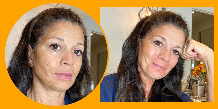 Illustration of writer Dina Eastwood during and after using the Hanacure facial mask
