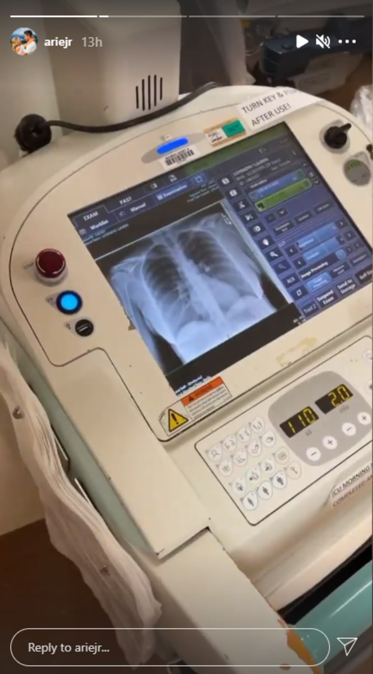 Lauren Burnham Luyendyk's chest X-ray