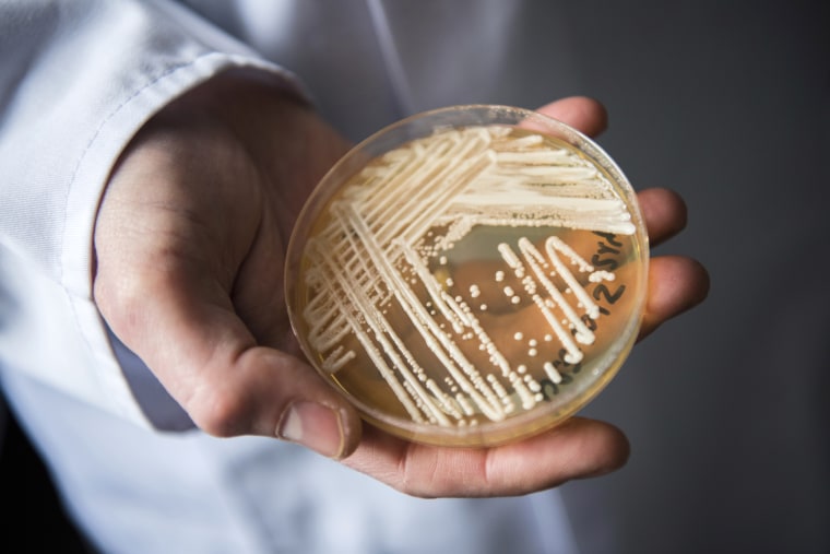 A petri dish holding the yeast Candida auris in a laboratory in Wuerzburg, Germany, on January 23, 2018.
