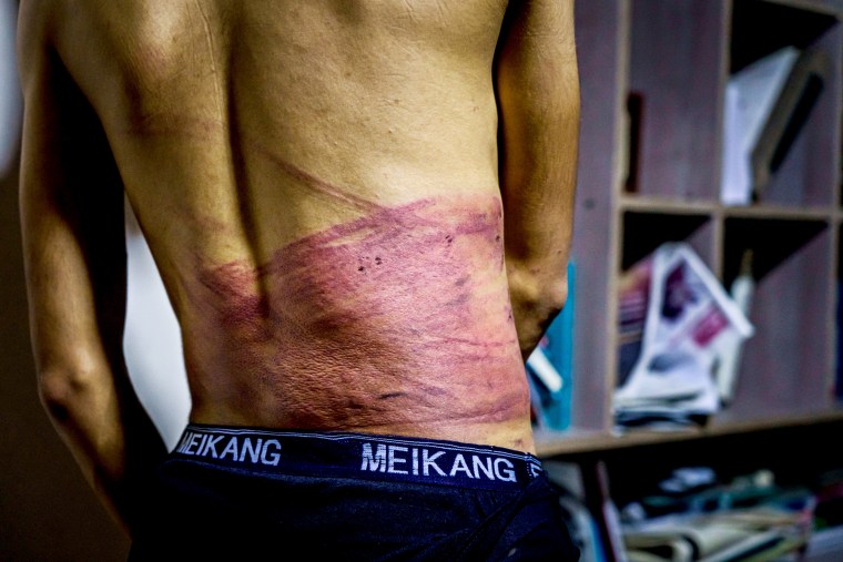 AFGHAN JOURNALIST TORTURED AND BEATEN BY TALIBAN