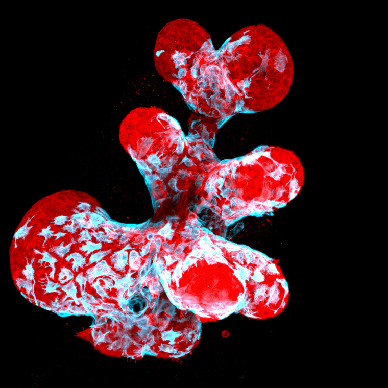 A breast organoid showing contractile myoepithelial cells, in blue, crawling on secretory breast cells, in red.