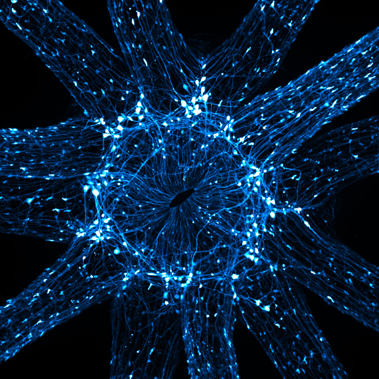 An in vivo snapshot of the neurons surrounding the mouth and tentacles of a juvenile starlet sea anemone.