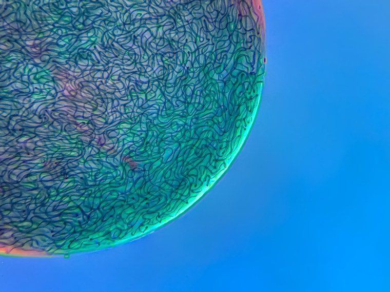 Filamentous strands of Nostoc cyanobacteria captured inside a gelatinous matrix.