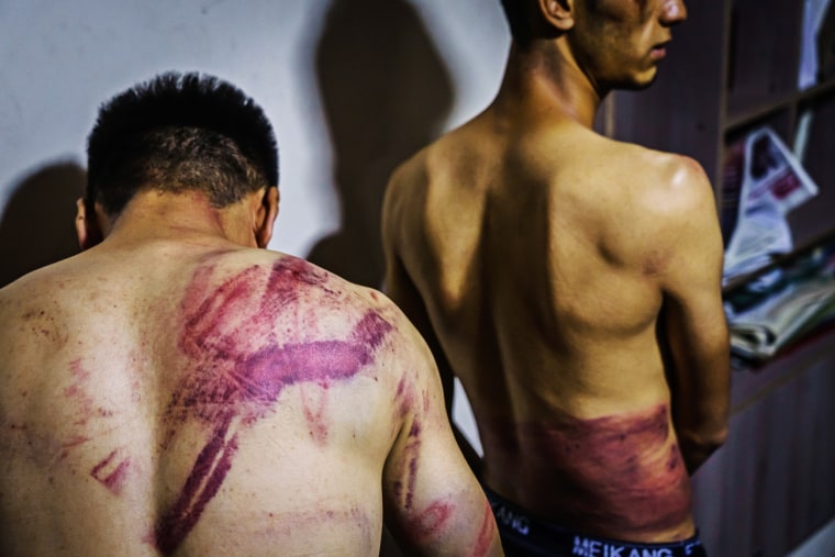 Journalists from the Etilaatroz newspaper, Nemat Naqdi, left, and Taqi Daryabi, undress to show their wounds sustained after Taliban fighters tortured and beat them while in custody after they were arrested for reporting on a women's rights protest in Kab