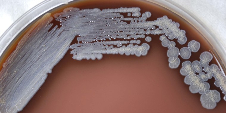 Exposure to Burkholderia pseudomallei bacteria can cause either severe pneumonia or a blood infection.