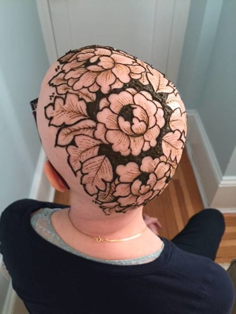Patricia Luchsinger embracing her hair loss as a result of chemotherapy. She got a henna design on her head for the holidays during her treatment.