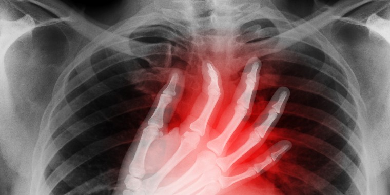 X-ray of hand on heart