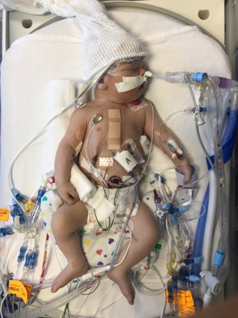 After his birth, Monty underwent surgery at Children's Hospital of Philadelphia after he was diagnosed with a rare congenital heart defect,. Now he is healthy and home with his family in Washington, D.C.