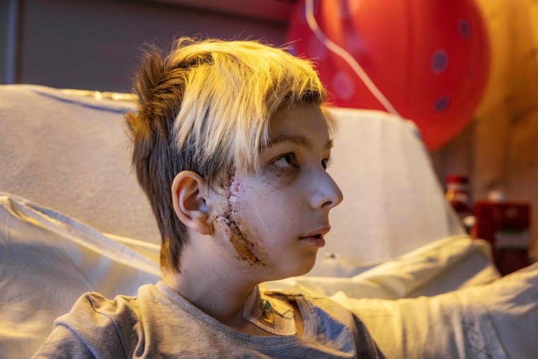 Volodymyr, 13, recovers in a Kyiv hospital on March 19 after his family's car was caught in crossfire between Russian and Ukrainian forces, killing his father and injuring his mother on Feb., 26, 2022.