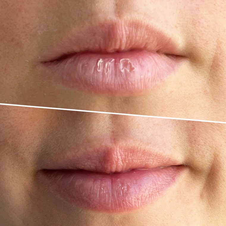 Shop TODAY contributor Julie Ricevuto's lips before and after using the E.l.f. Lip Exfoliator treatment.