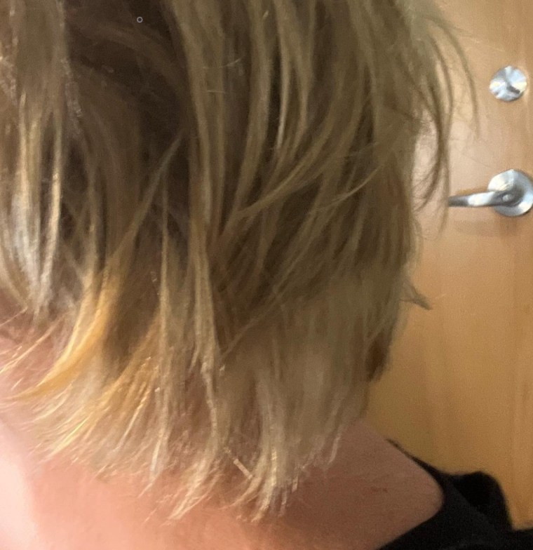 Mika Brzezinski says she has been struggling with hair loss since the summer.