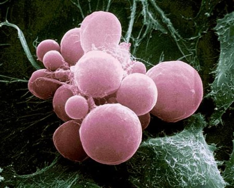 The scanning electron micrograph shows mammalian, malignant tumor cells