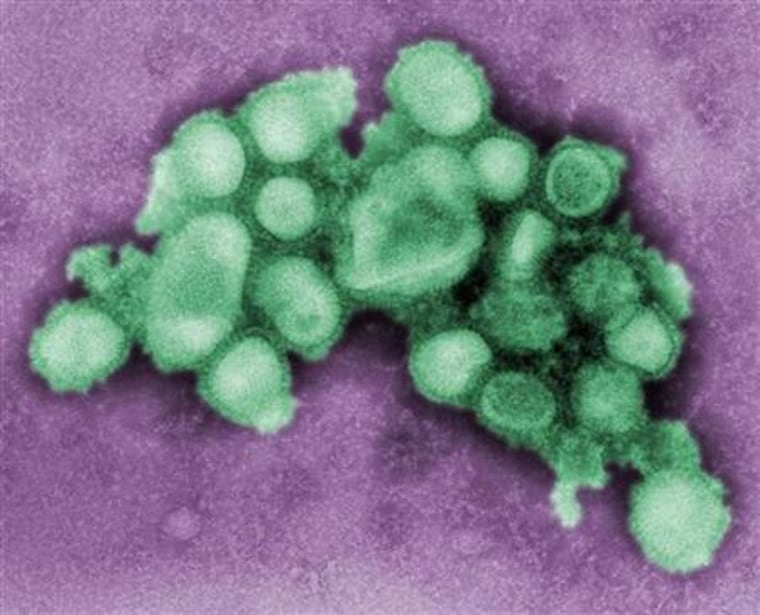 A negative stained electron micrograph image shows an H1N1 \"swine flu\" virus culture in Atlanta