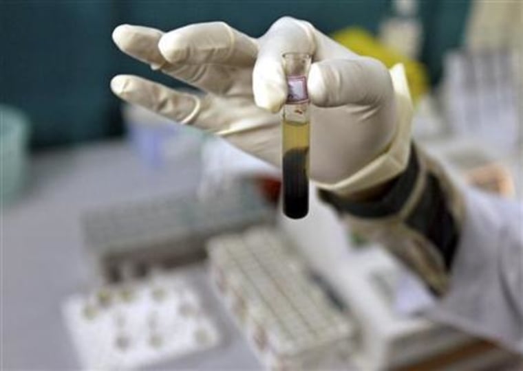 A laboratory assistant examines a blood sample inside a laboratory