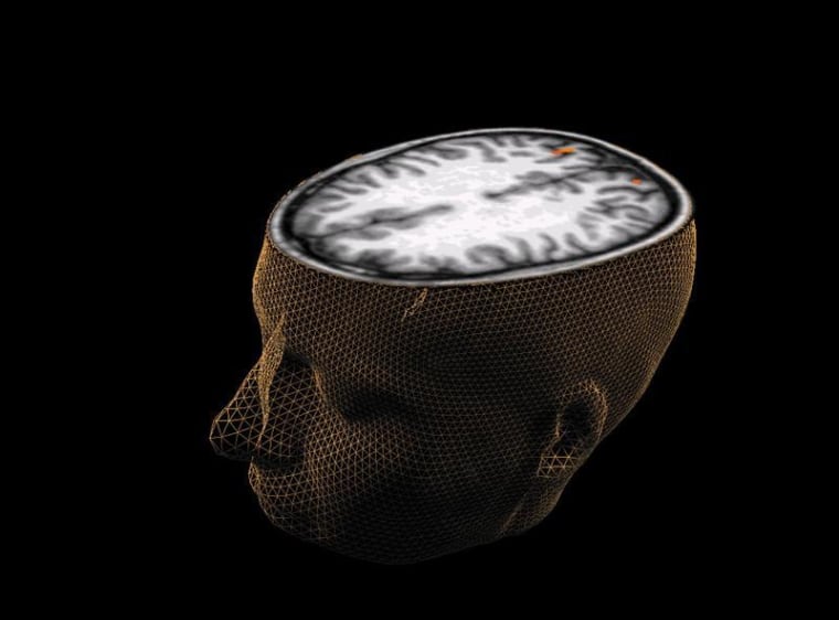 An undated image of the human brain taken through scanning technology