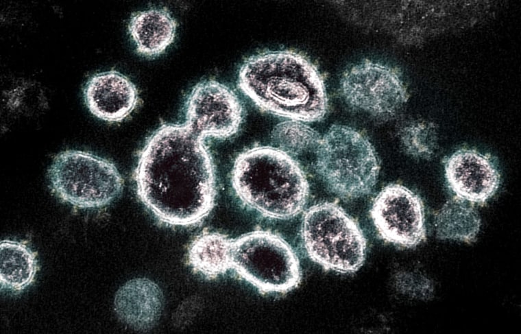 A transmission electron microscope image of SARS-CoV-2, the virus that causes Covid-19, isolated from a patient.
