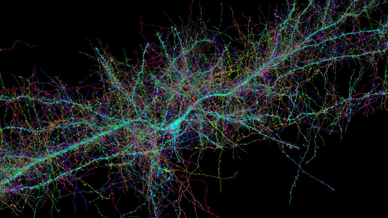 Image: An image compiled by researchers shows nerve cells inside a woman's brain.