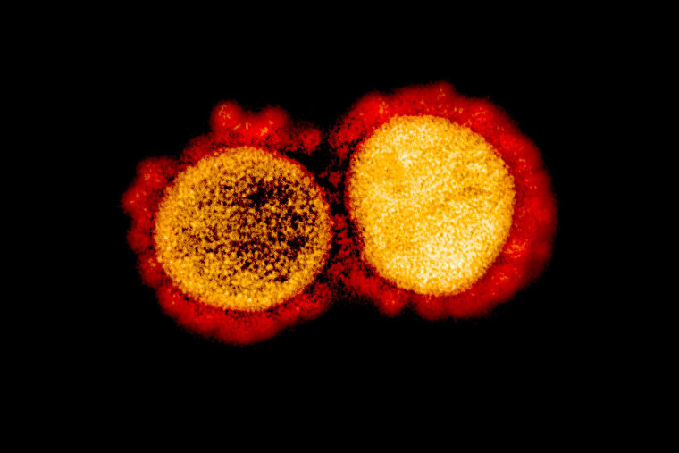 A transmission electron micrograph of SARS-CoV-2 virus particles.