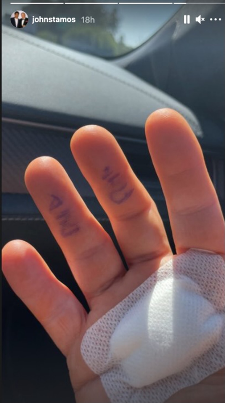 Stamos also included a photo of his hand that showed his bandaged palm.