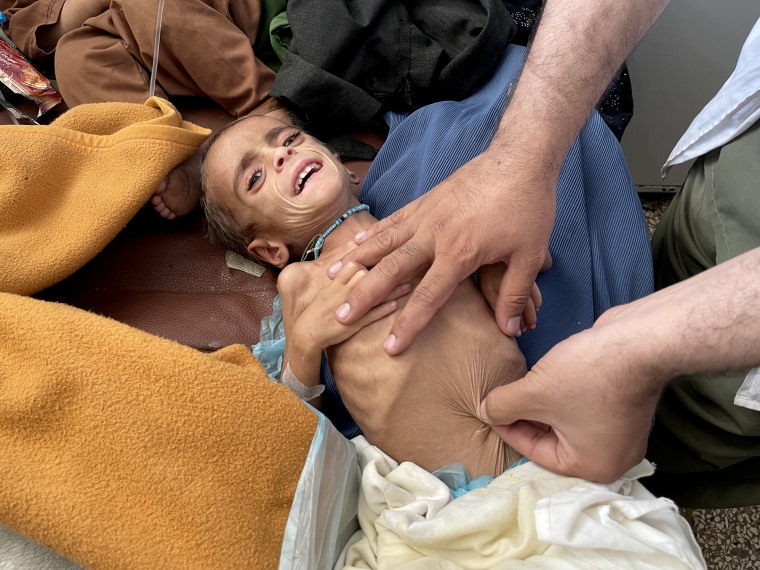 Afghan children face death from starvation