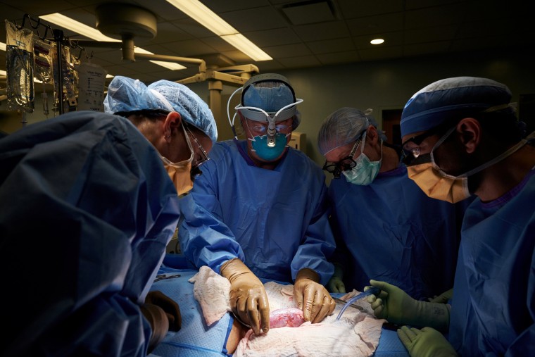 The surgical team examines the pig kidney for any signs of hyperacute rejection, as the organ was implanted outside the body to allow for observation and tissue sampling during the 54-hour study period, at NYU Langone in New York, U.S., in this undated handout photo.