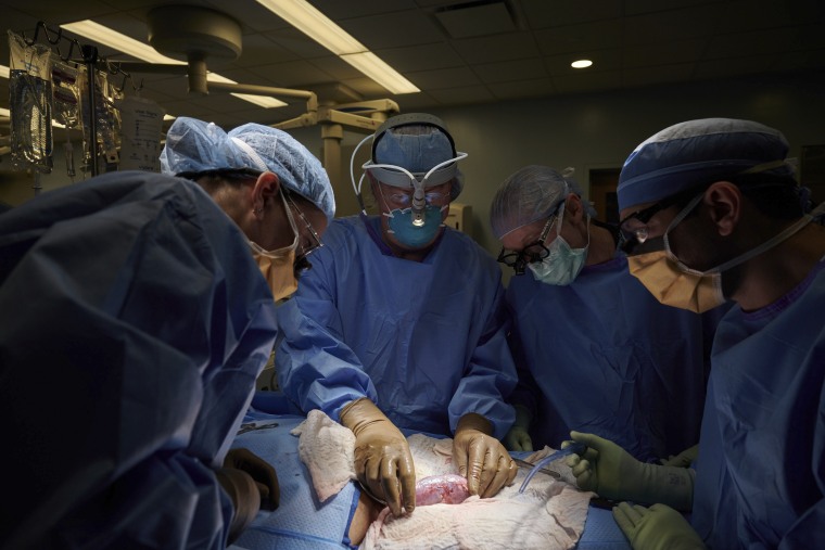 En esta fotografía de septiembre de 2021, facilitada por el centro médico Langone Health, de la Universidad de Nueva York, un equipo quirúrgico examina un riñón de cerdo unido al cuerpo de una donadora fallecida.