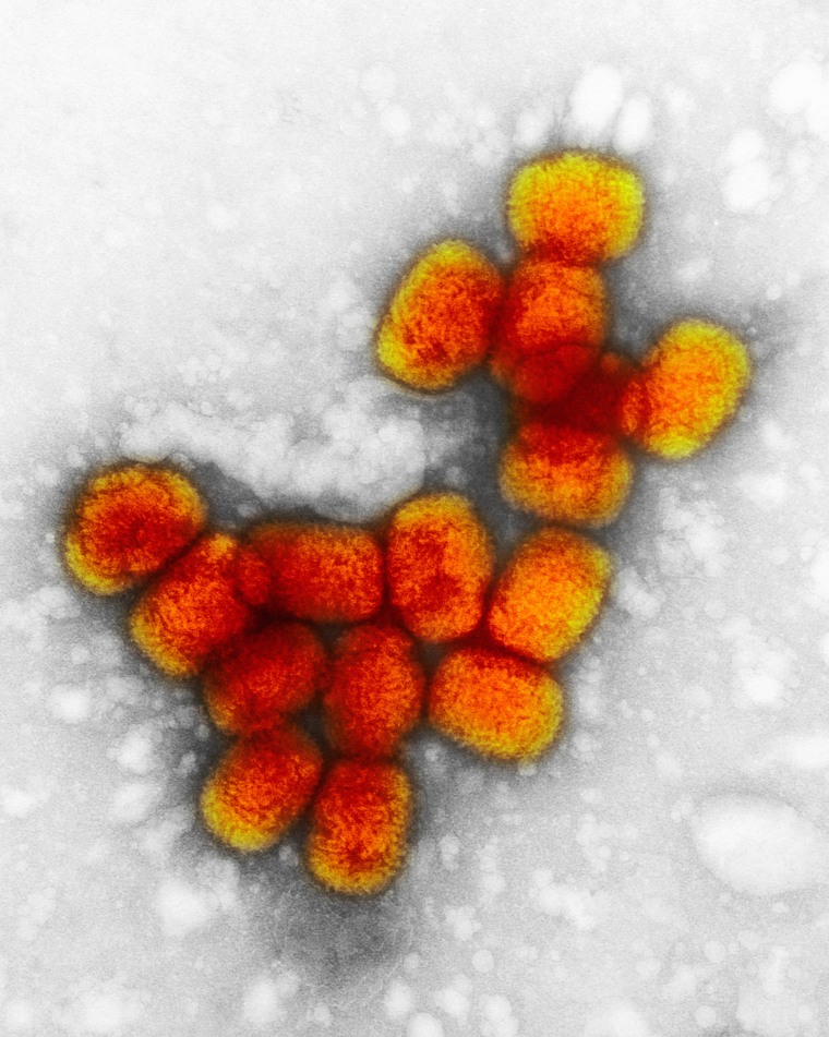 Image: A transmission electron micrograph of smallpox viruses.