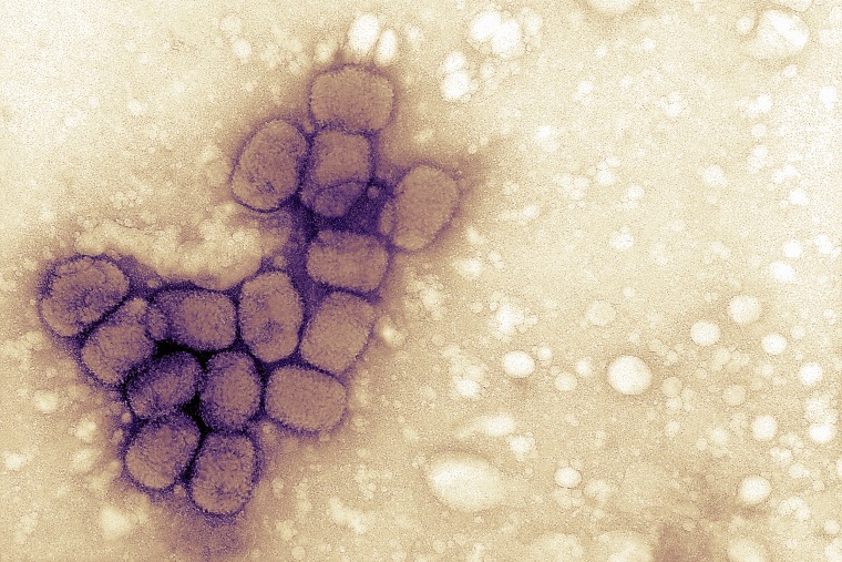 Image: EM image variola (smallpox) viruses