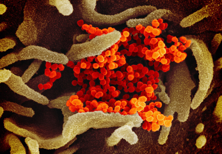 This scanning electron microscope image shows SARS-CoV-2 (orange) also known as 2019-nCoV, the virus that causes Covid-19.