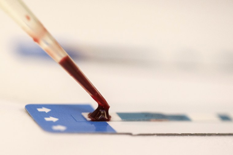 Una enfermera analiza una muestra de sangre durante una prueba gratuita del VIH.