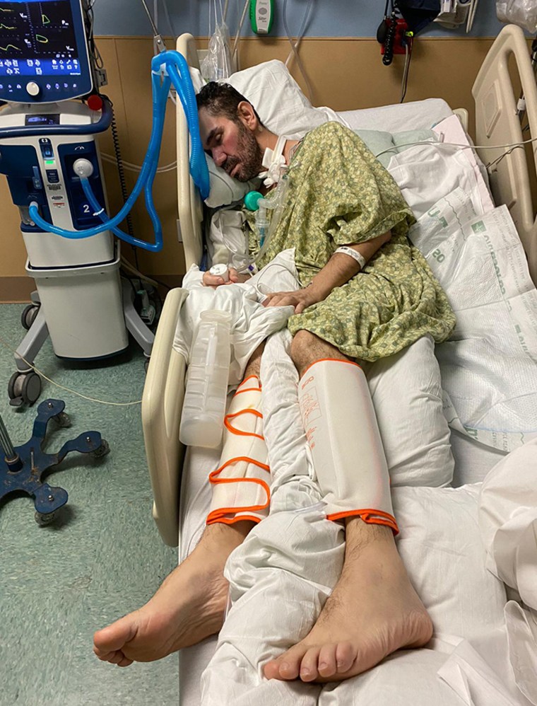 Hernando Rodríguez cuando se encontraba inconsciente y paralizado en el hospital. Debía usar botas de compresión especiales para estimular su circulación y que no se formaran coágulos que pusieran su vida en riesgo.