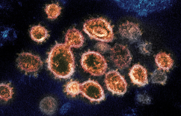Partículas del virus del SARS-CoV-2, causante del COVID-19, de un paciente en EE.UU.