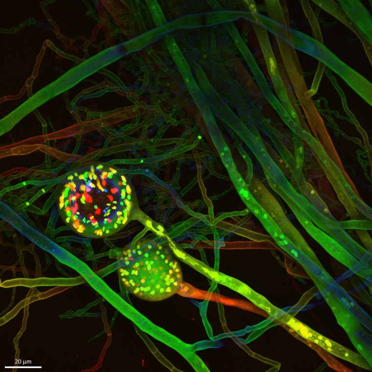 Confocal 3D-image of a fungal network with reproductive spores containing nuclei.