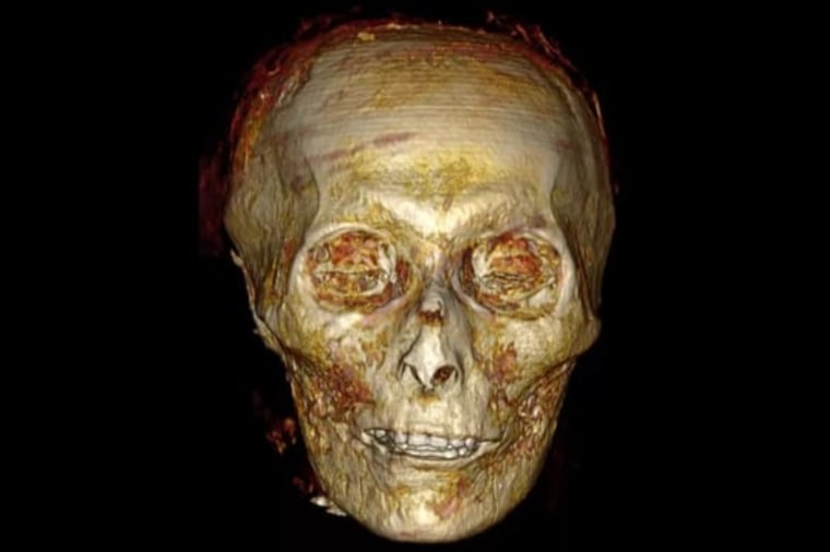 Una imagen con un scáner CT de la cabeza del faraón Amenhotep I