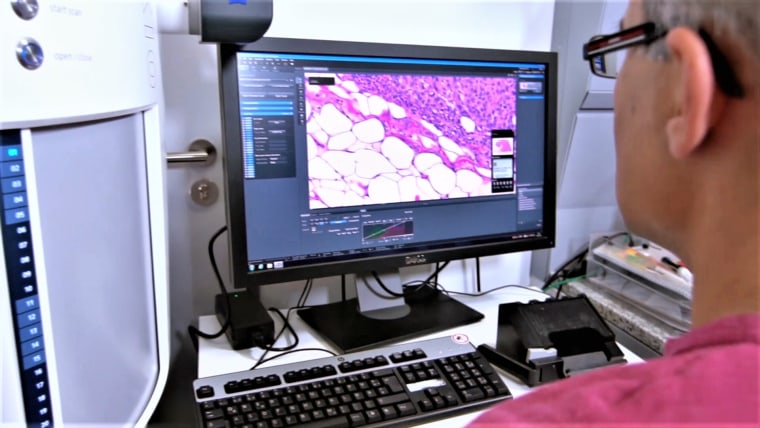 A researcher looks at stained tissue from a patient's tumor sample.