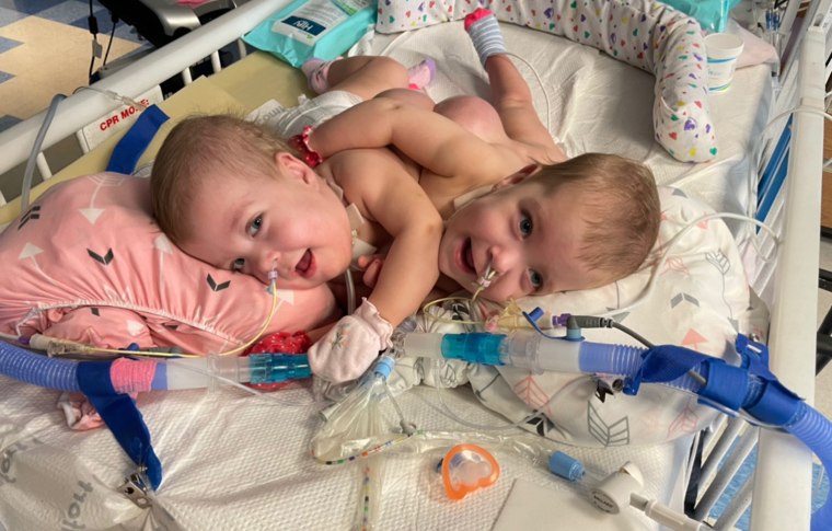 Addy and Lily were always happy, smiling babies and continue to bring joy to their family now that they're home after being separated.