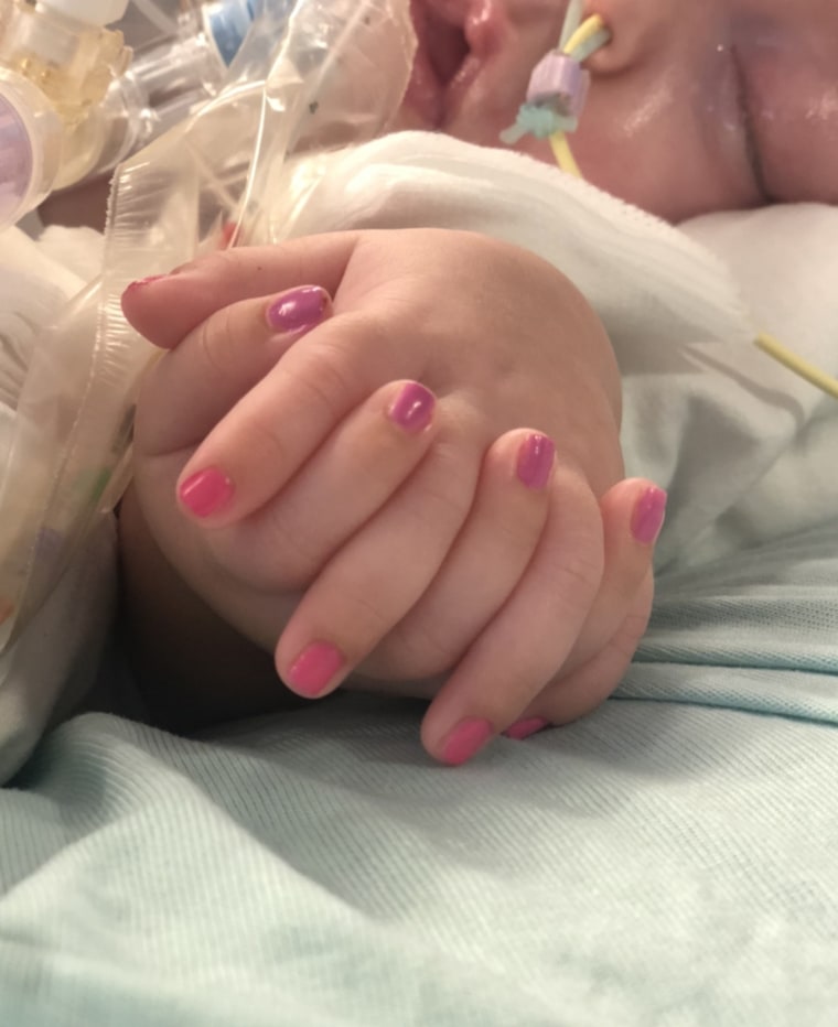 Holding hands before surgery.