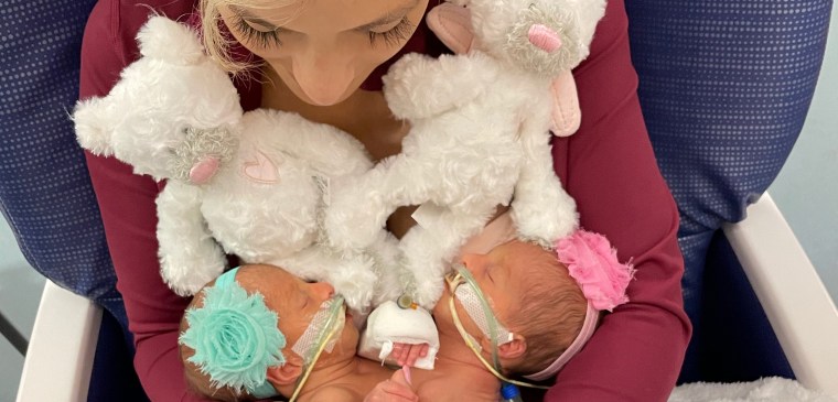 Mom Maggie Altobelli holds Lily and Addy, joined at abdomen, shortly after they were born. She wrote them a letter before their risky separation surgery.