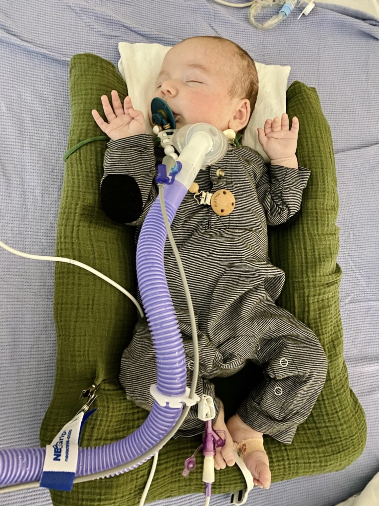 Baby Oliver is thriving at the hospital. He can't go home quite yet; his family is waiting for a home health nurse to help him because he has a trach to help his breathing. 