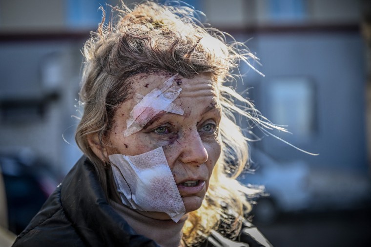 A wounded woman stands outside a hospital after the bombing of the eastern Ukraine town of Chuguiv on Feb. 24 as Russian armed forces invaded Ukraine from several directions.