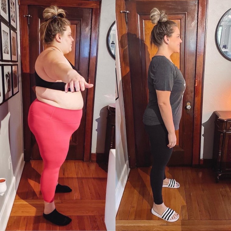 Before undergoing weight loss surgery, Jessica Limpert and Ramon Medeiros talked to other people who did it. They decided it was right for them.