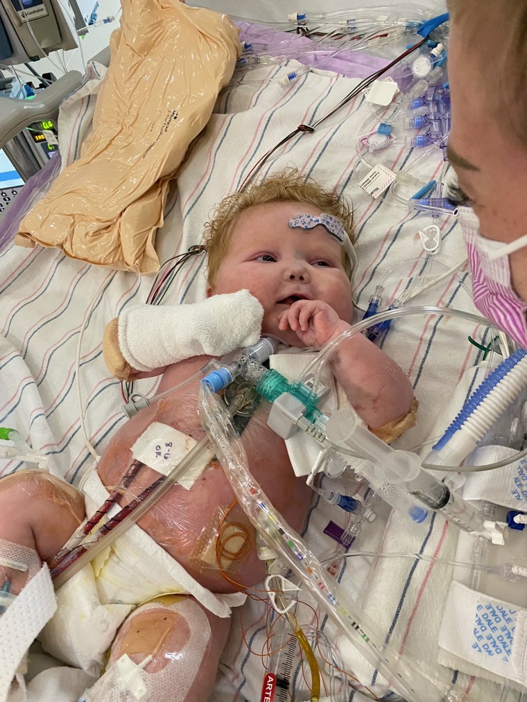 Easton smiling at his mom for the first time after his transplant.