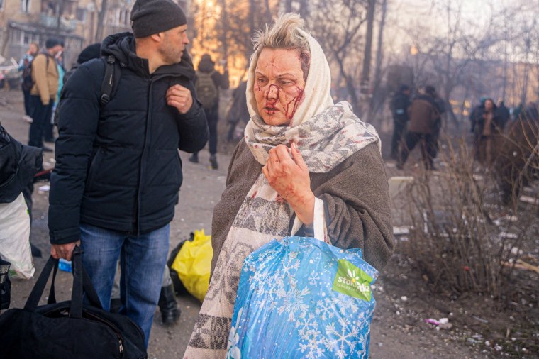 An injured woman is evacuated from a building damaged by shelling in Kyiv