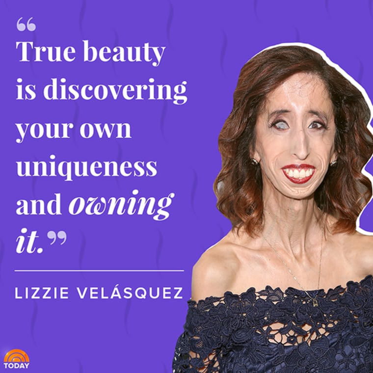 Famous Women in HIstory: Lizzie Velásquez