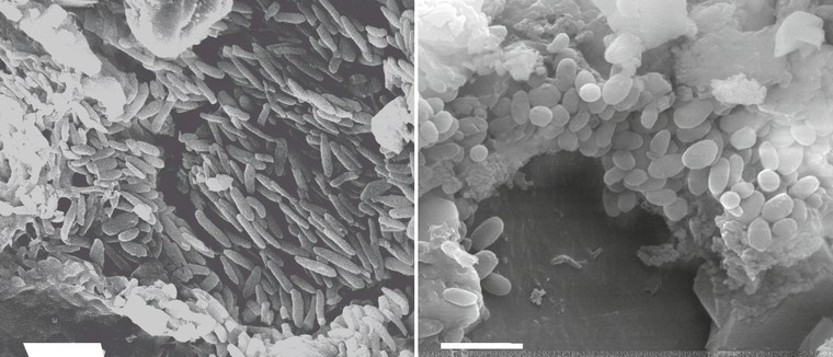 A micrograph of preserved melanosomes in the two feather types associated with the Brazilian pterosaur. On the left are the elongated melanosomes found in the monofilaments, and on the right are the stubby, short melanosomes found in the branched feathers.