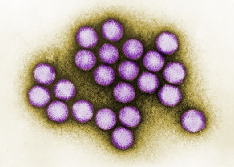 Transmission electron microscopic (TEM) image of some of the ultrastructural details exhibited by a small cluster of adenovirus virions.