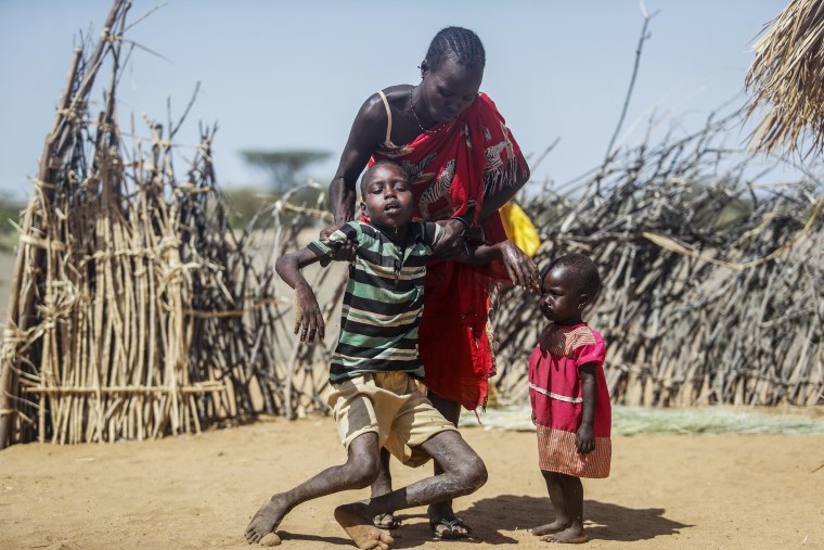 A mother helps her malnourished son stand after he collapsed in their village, Lomoputh, in northern Kenya this month.