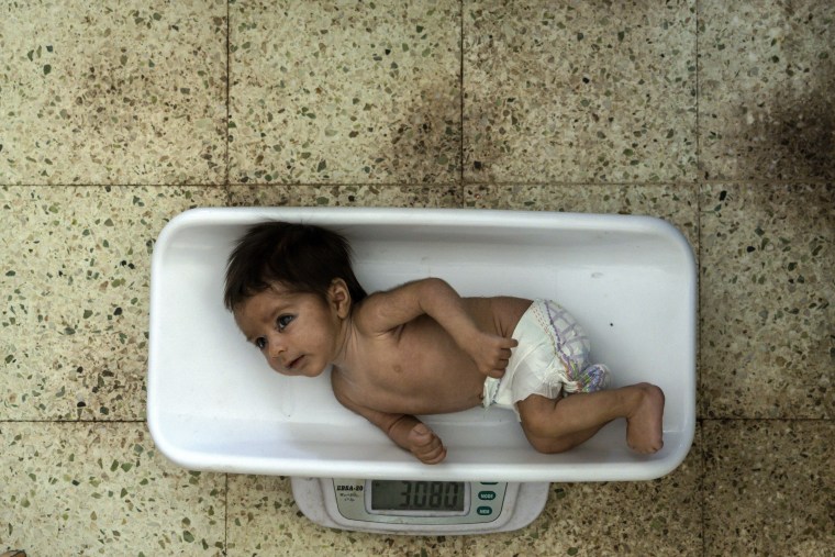 Image: Children Malnutrition